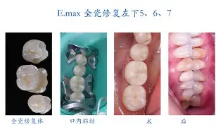 剠?5{+Z&amp;磟;=^寽跾#y?o\(弜嵌洶鯫e鰱龅-爱游戏体育app